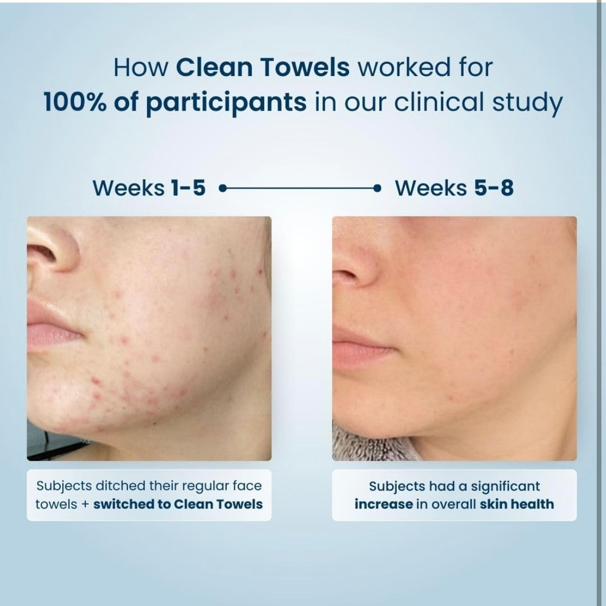 Clean Skin Club Face Towels for Acne