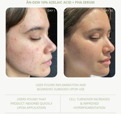 Anfisa ÂN-DEW 10% Azelaic Acid + PHA Serum 30ml