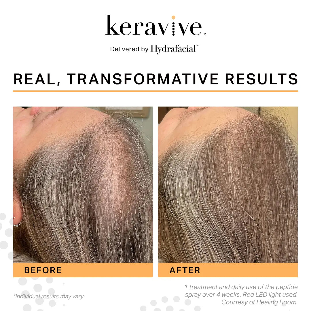 Keravive Peptide Hair Growth Spray