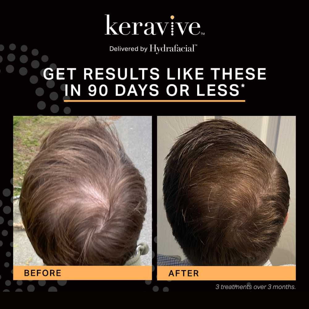 Keravive Peptide Hair Growth Spray