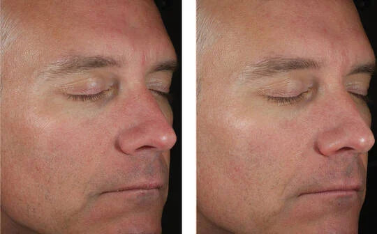 Skinbetter Solo Hydrating Defense Men