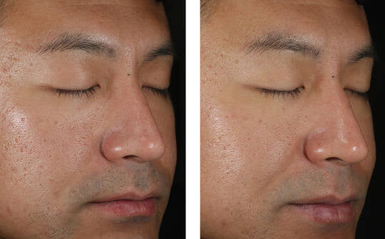 Skinbetter Solo Hydrating Defense Men