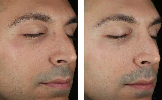 Skinbetter Solo Hydrating Defense Men