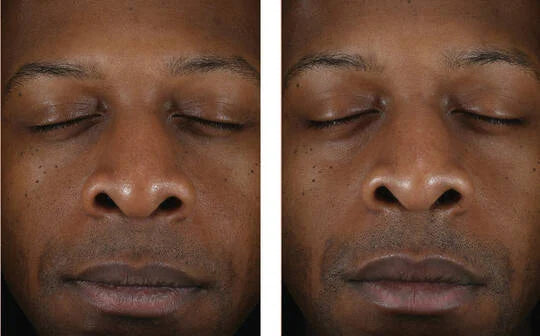 Skinbetter Solo Hydrating Defense Men