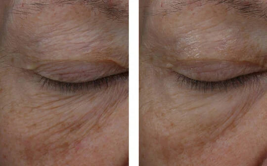 Skinbetter InterFuse Treatment Cream EYE