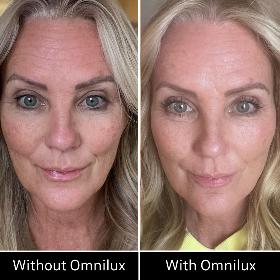 Omnilux Contour LED Face Mask