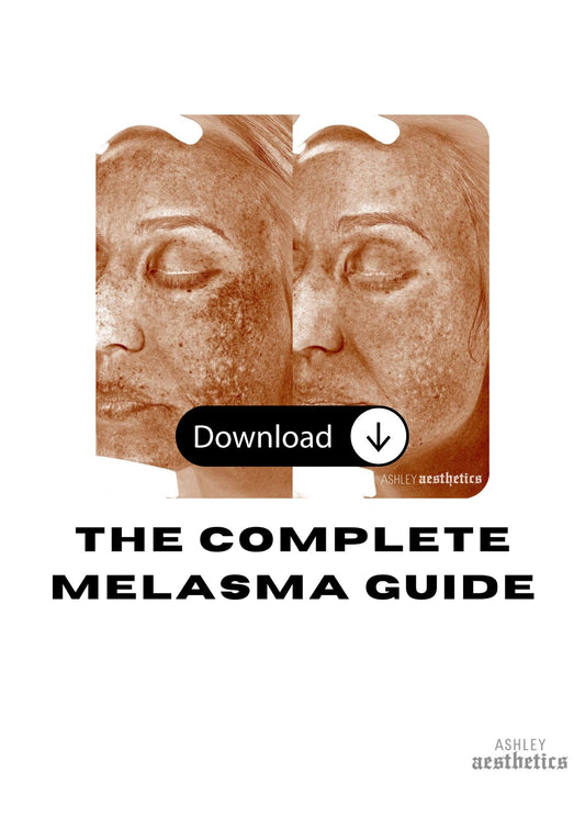 The Complete Melasma Guide COMING SOON